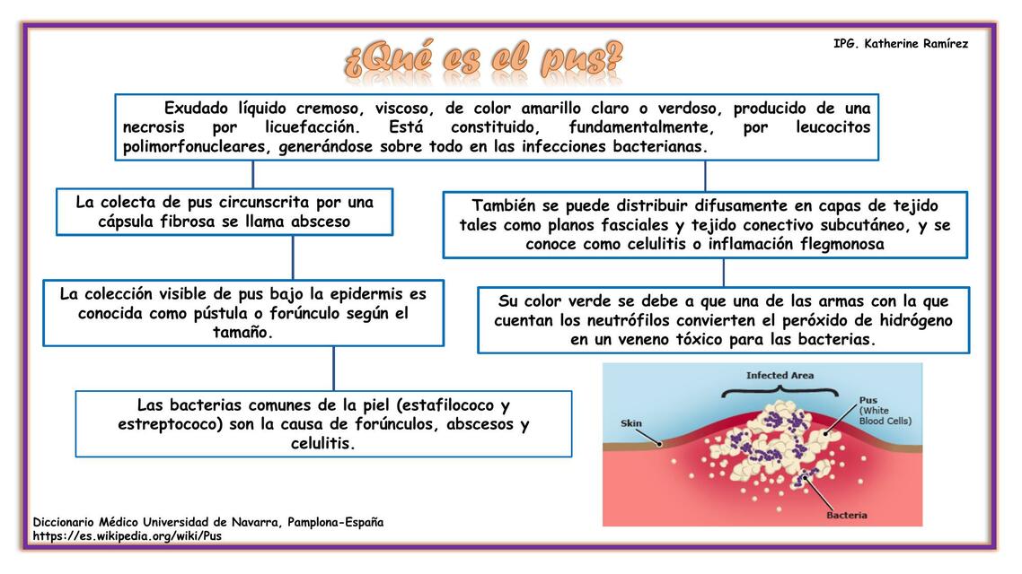 Qué es el pus 𝑲𝒂𝒇𝒆𝒔𝒉𝒊𝒕𝒐02 uDocz