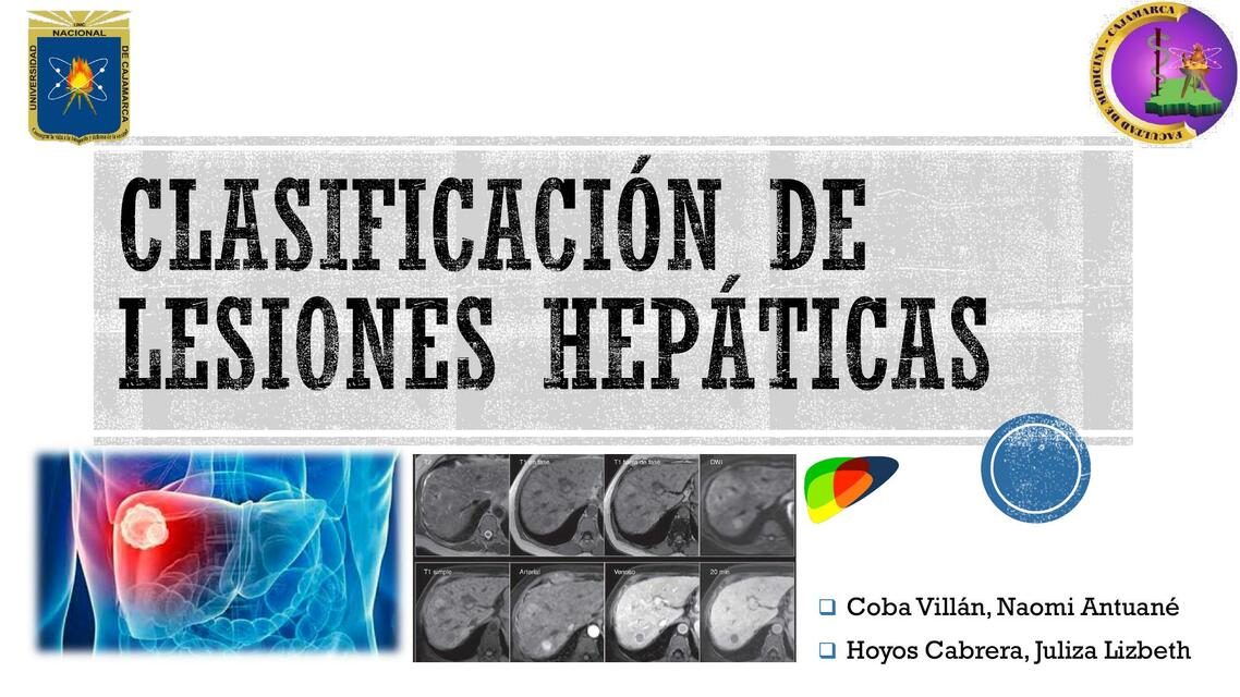 Clasificación de Lesiones Hepáticas 