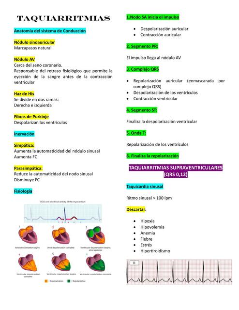 Taquiarritmias 
