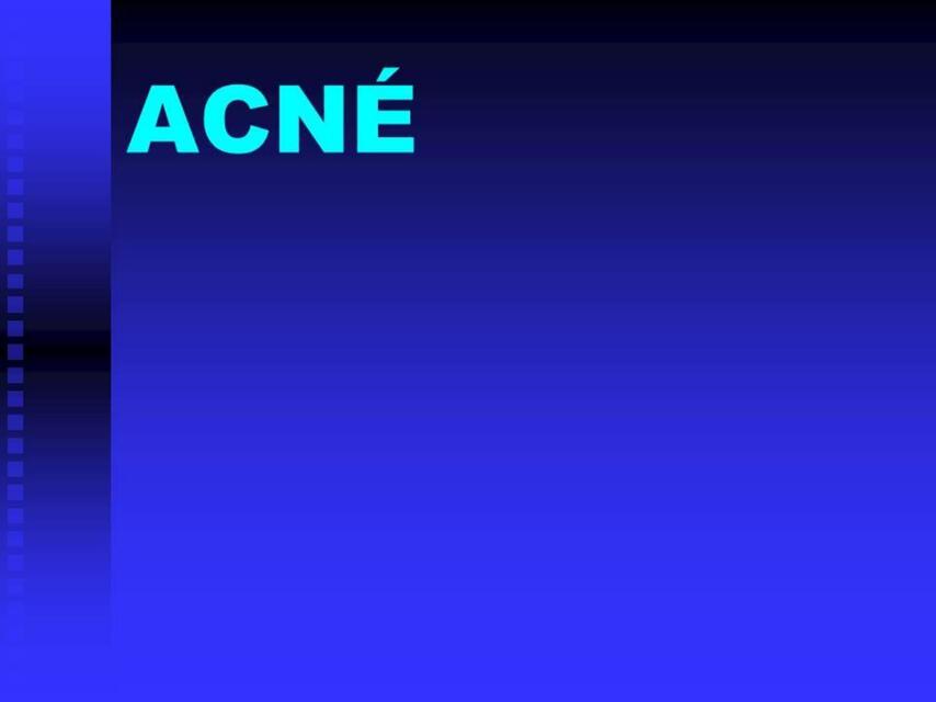 Acné 