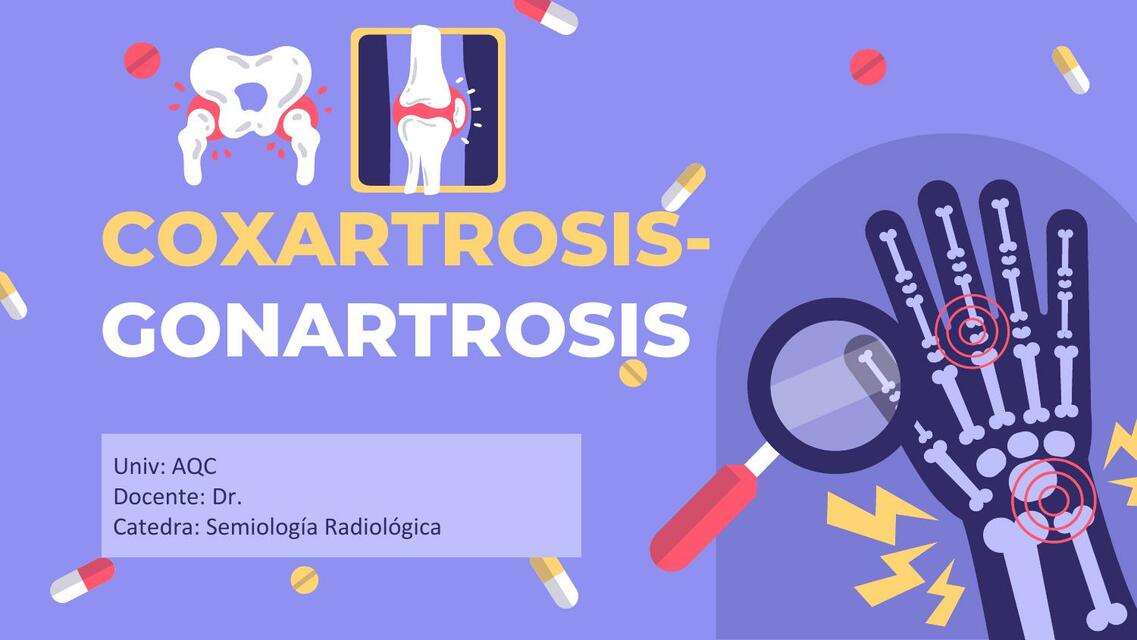 Coxartrosis y gonartrosis 