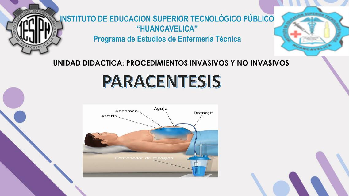 Paracentesis 