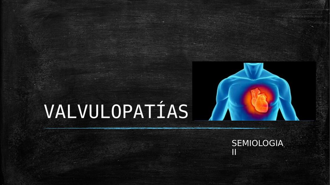 Valvulopatías 