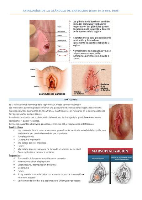 Patologías de la glándula de Bartolino