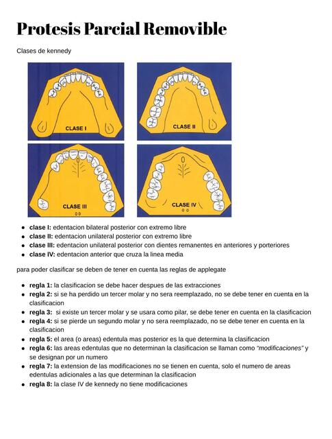 Prótesis Parcial Removible 