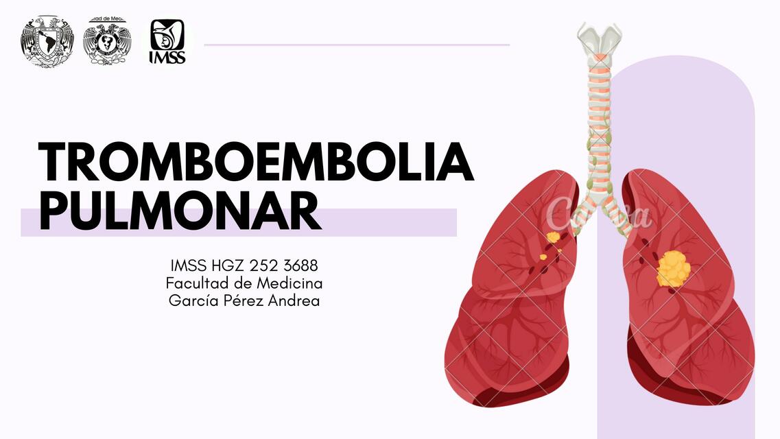 Tromboembolia Pulmonar 