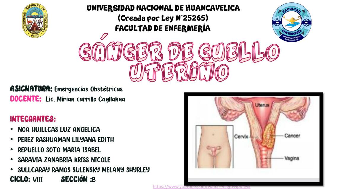 Cáncer de Cuello Uterino 