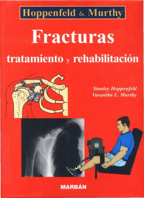 Fracturas- Tratamiento y Rehabilitación 