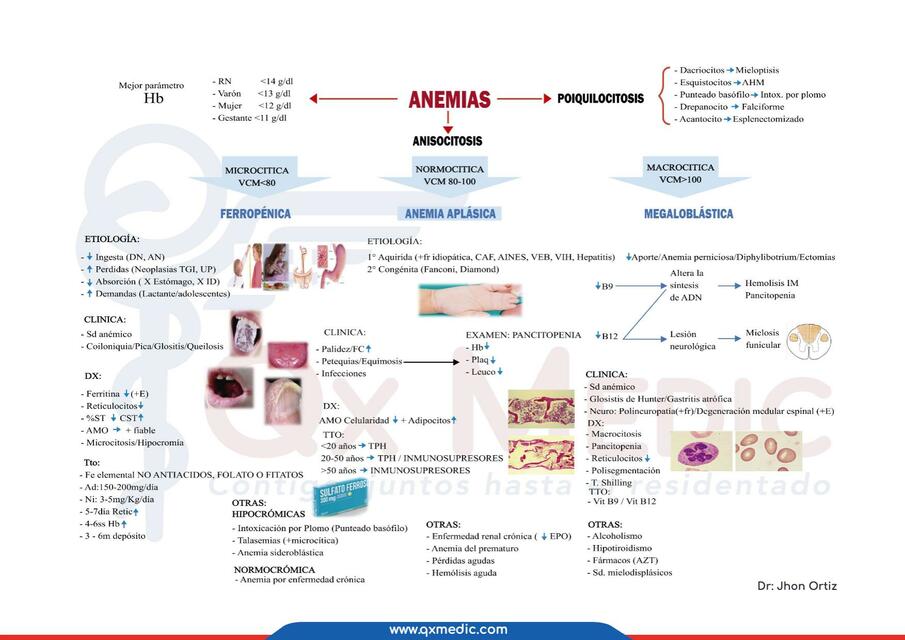 Anemias 