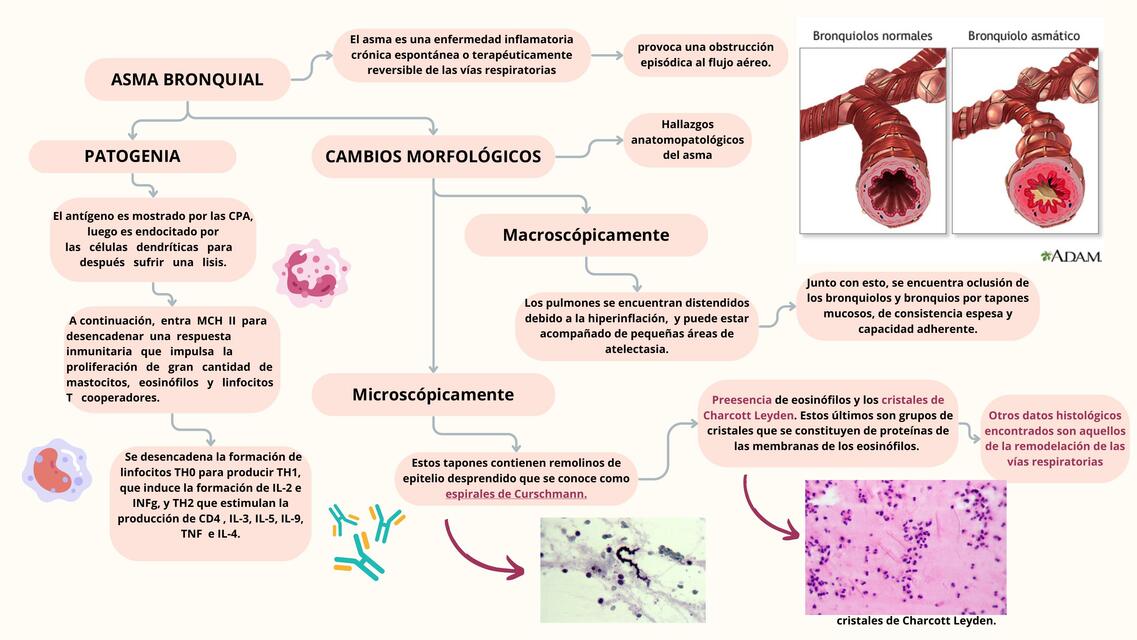 Asma Bronquial 