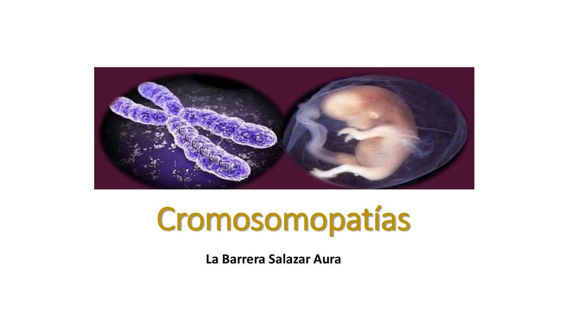 Cromosomopatías La Barrera Salazar Aura