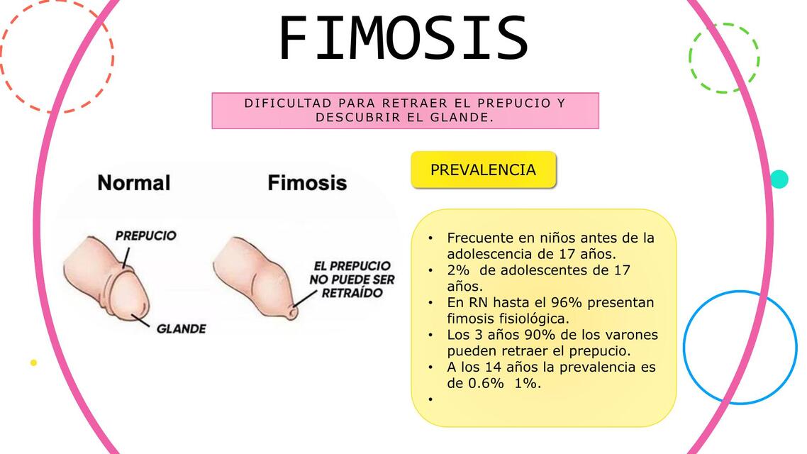 Fimosis Milagros UDocz Fimosis Milagros UDocz