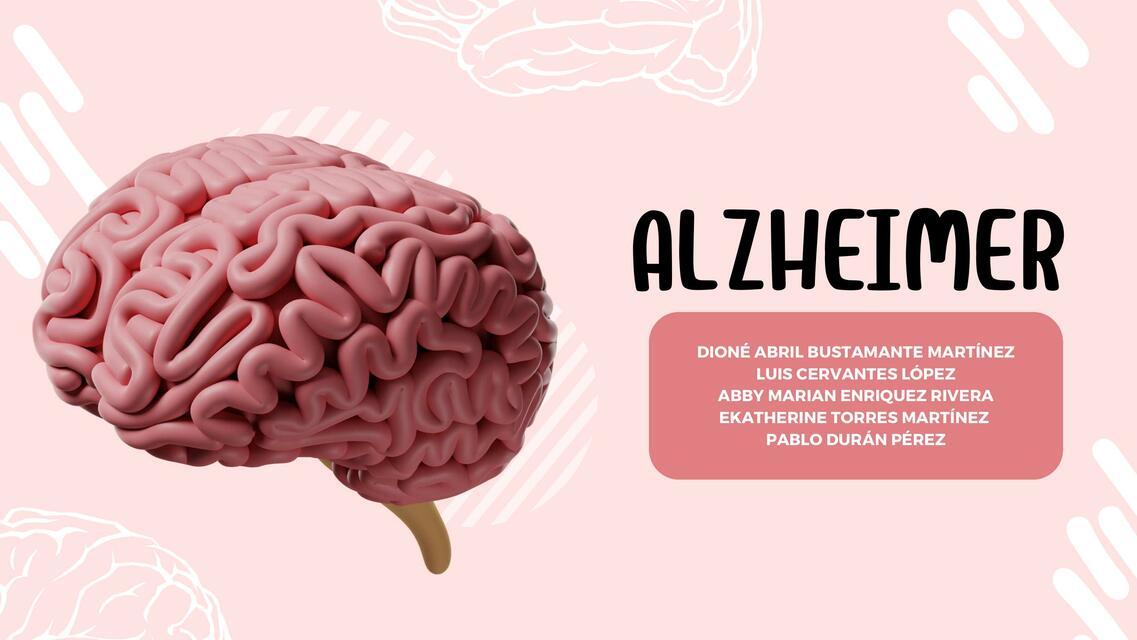 ALZHEIMER