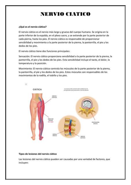 Nervio Ciático  