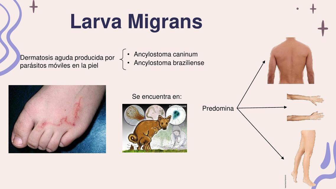 Larva Migrans 