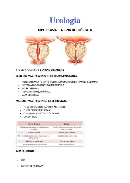 Hiperplasia benigna de próstata  