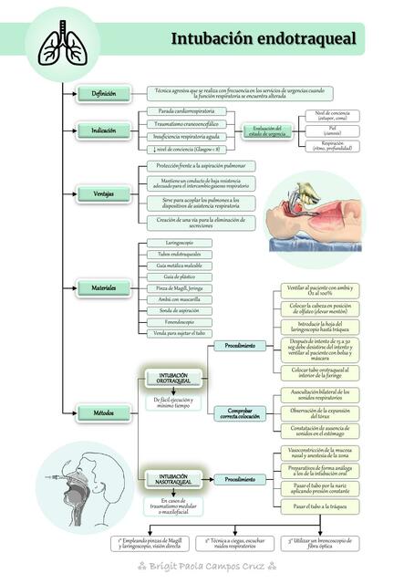 Intubación Endotraqueal