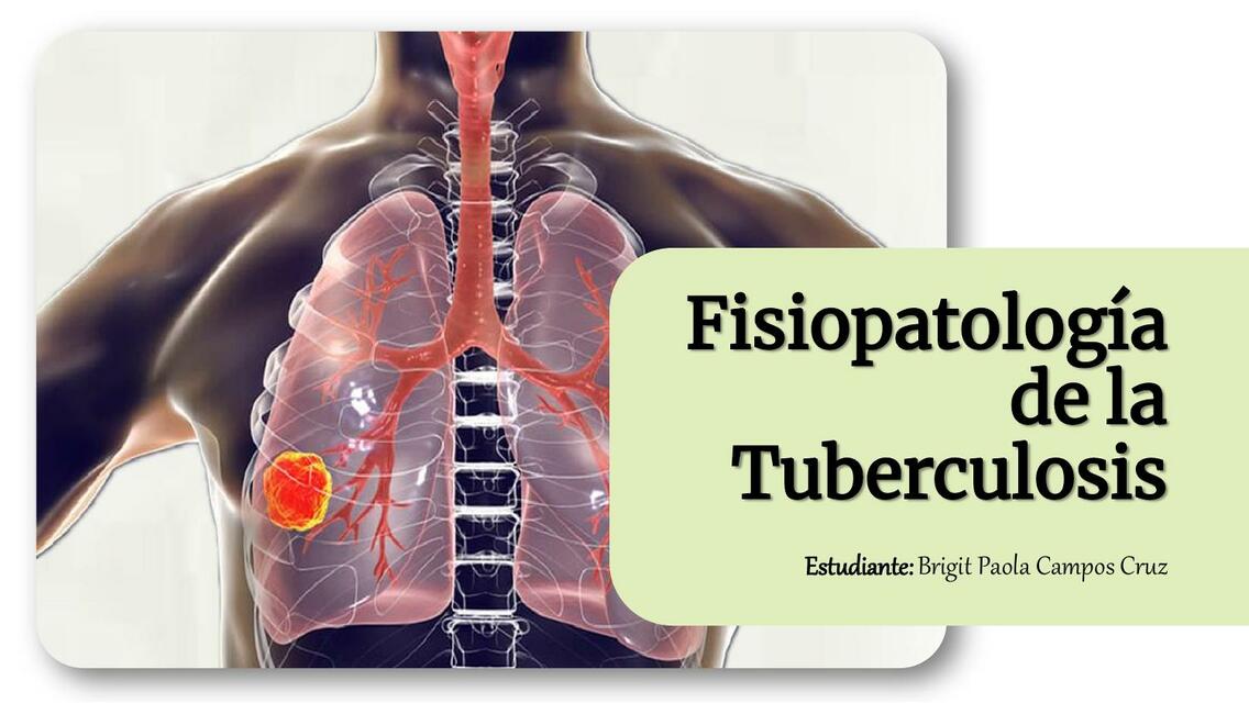 Fisiopatología de la Tuberculosis