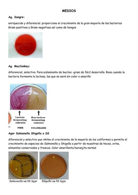 Muestra de cultivo de bacteriología