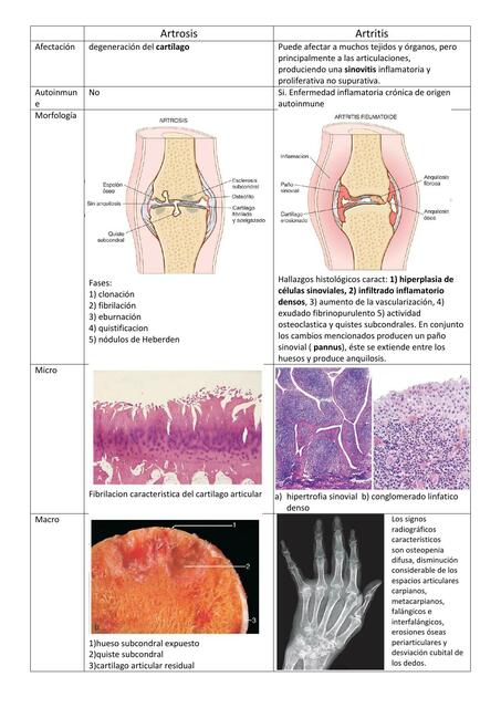 Artrosis y artritis