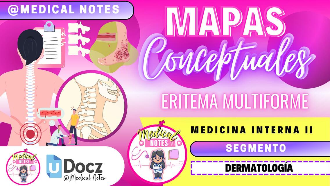 Eritema multiforme. MEDICAL NOTES uDocz