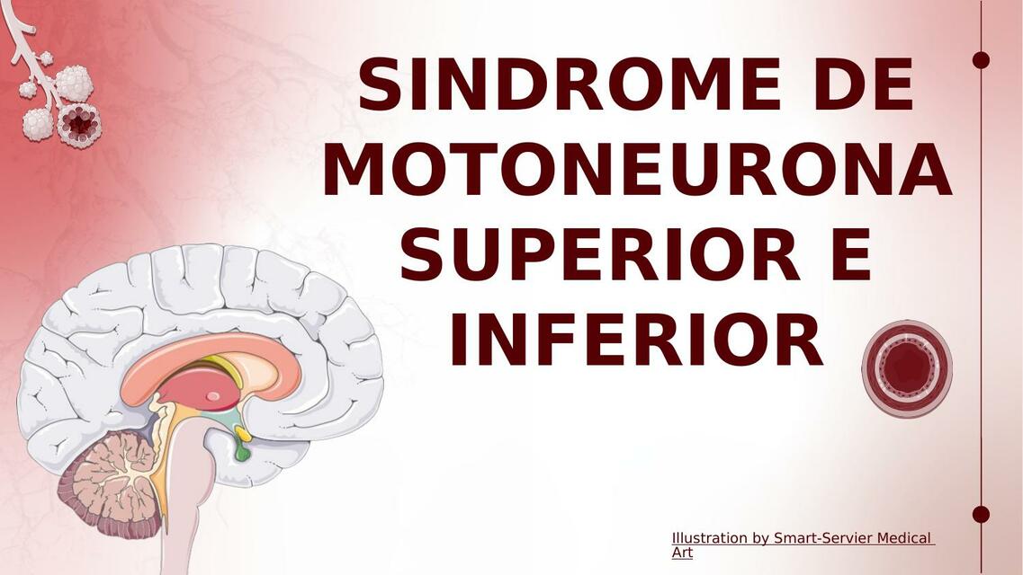 SINDROME DE MOTONEURONA SUPERIOR E INFERIOR