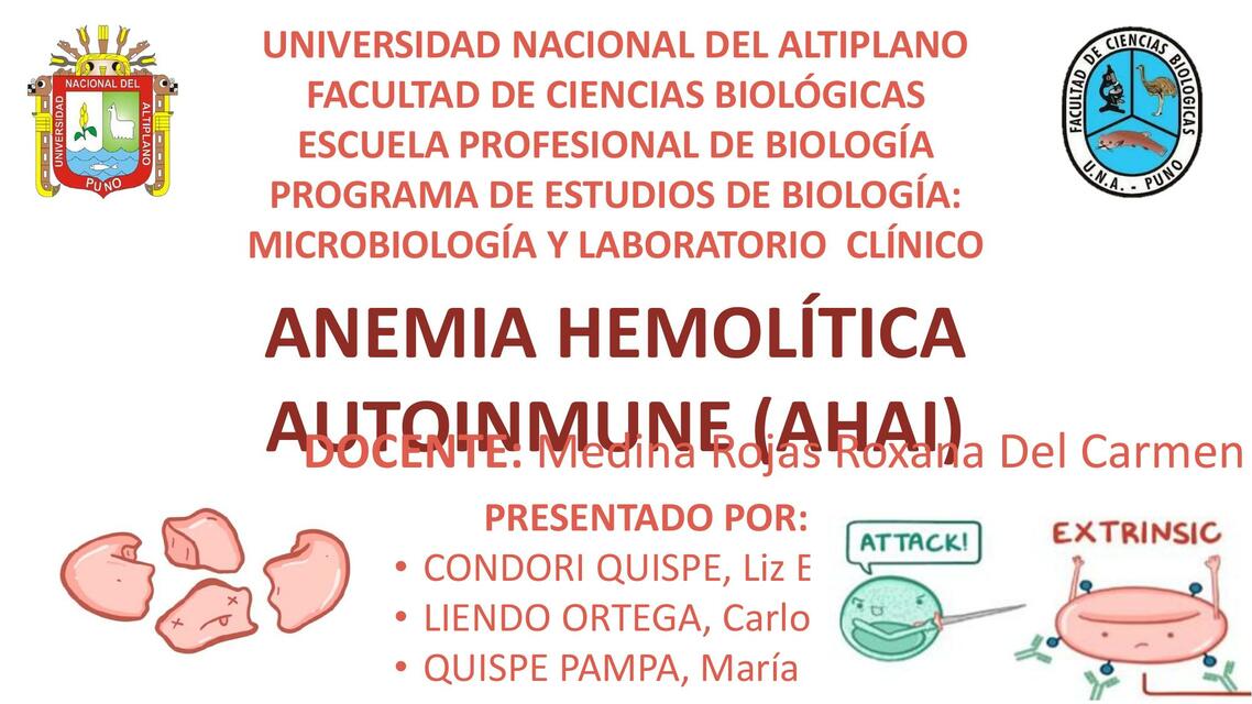 Anemia Hemolítica Autoinmune