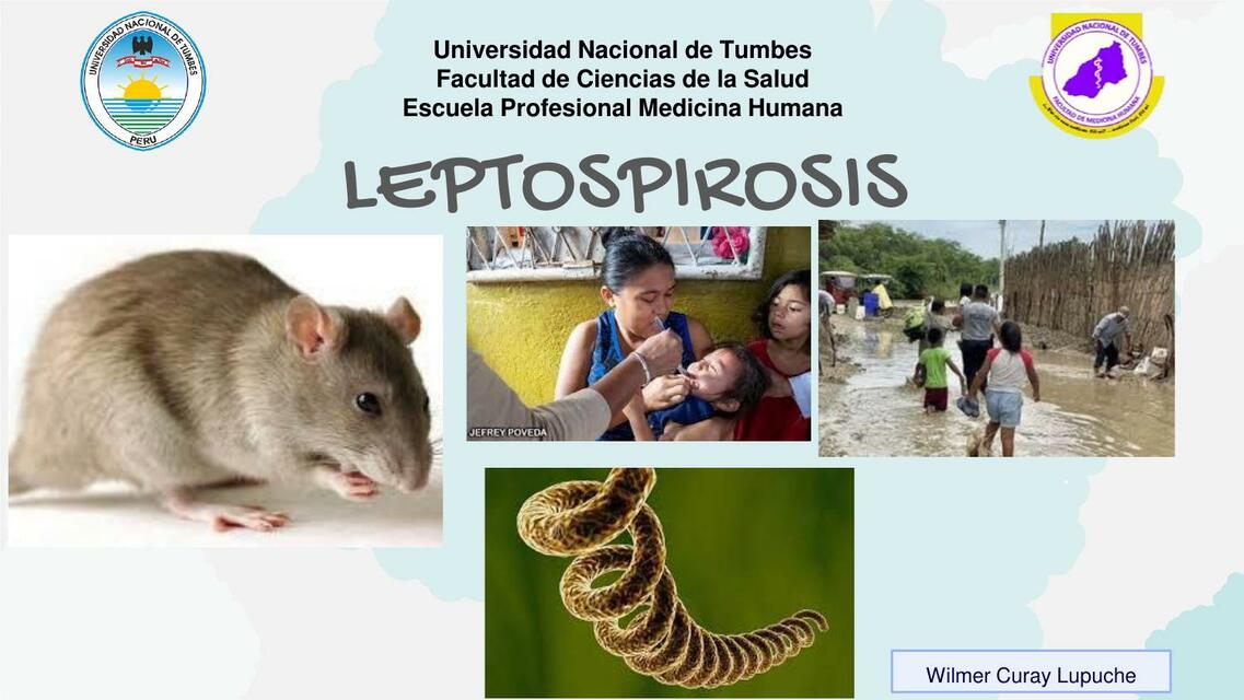 Leptospirosis