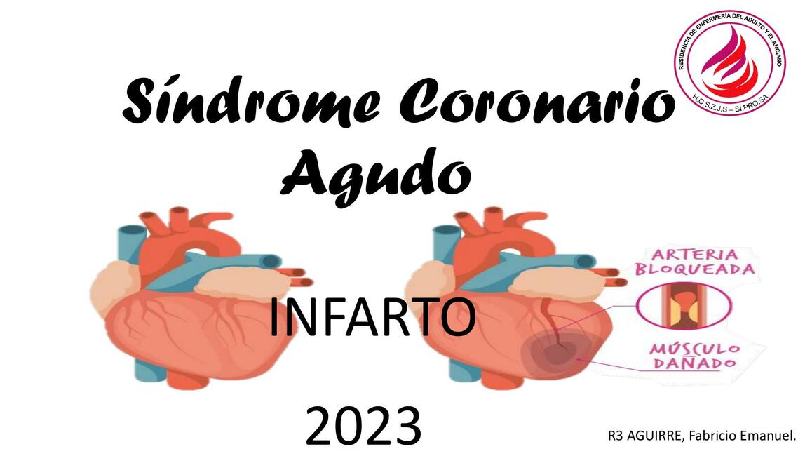 Síndrome Coronario Agudo