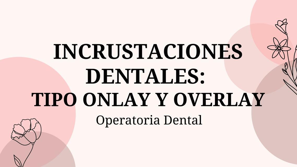 Incrustaciones Dentales: Tipo Onlay y Overlay