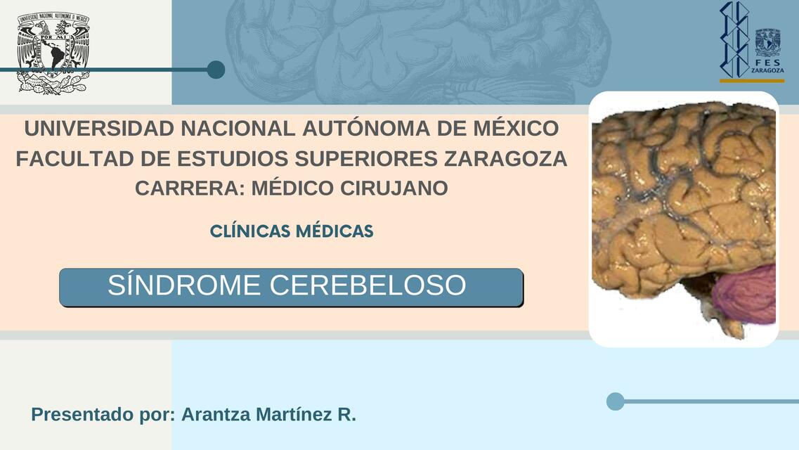 síndrome cerebeloso