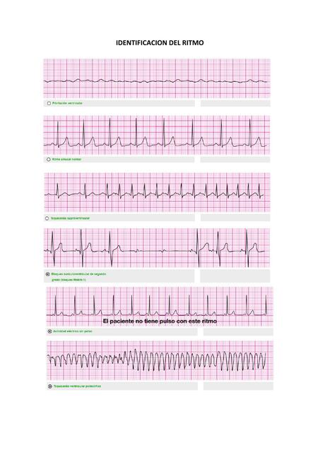 Identificación del ritmo 