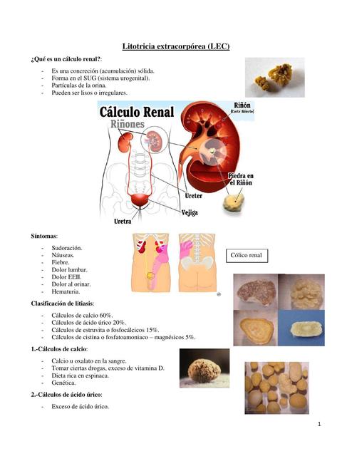 Clase 10 Litotripcia Extracorporea