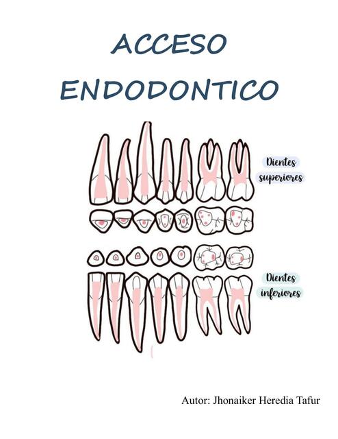 acceso endodóntico y anatomía