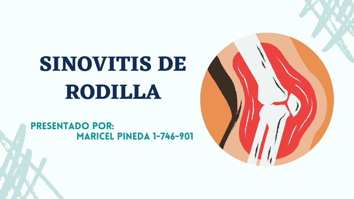 Sinovitis de rodilla