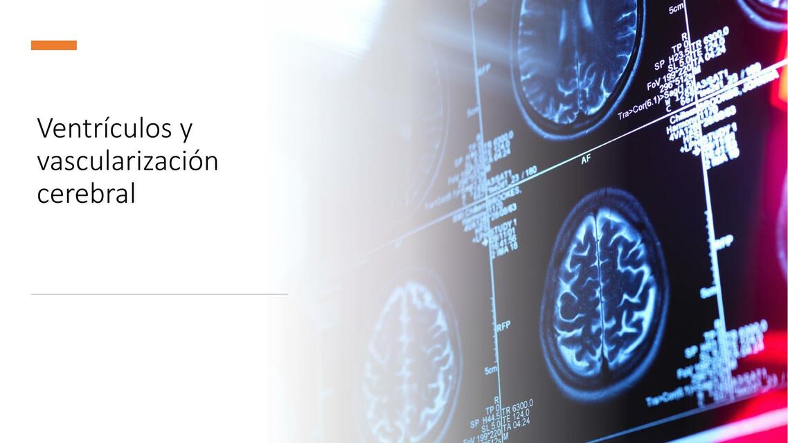 Ventrículos Cerebrales y Vascularización cerebral