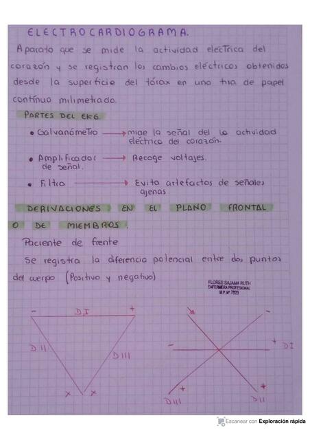 resumen electrocardiograma