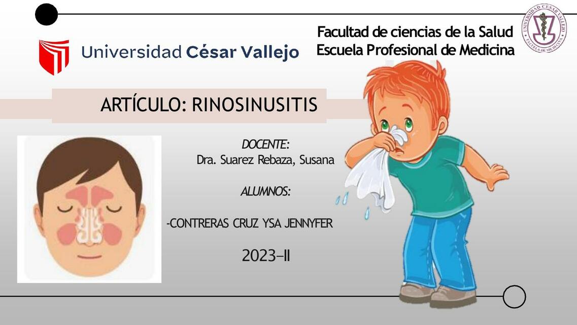 Artículo rinosinusitis