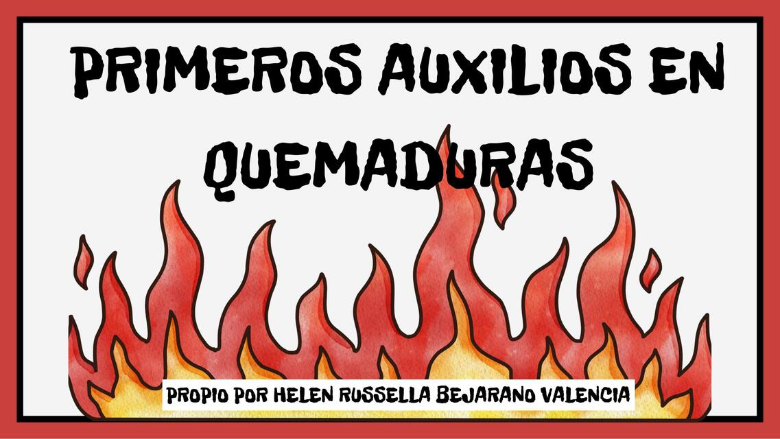 Primeros auxilios en quemaduras 