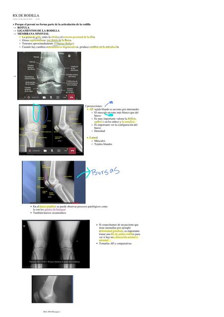 RX DE RODILLA