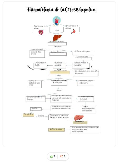 fisiopatologia de cirrosis 