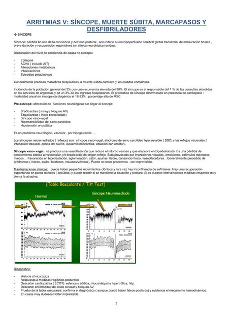 Síncope resumen de nerologia medica basado en harrison medicina interna