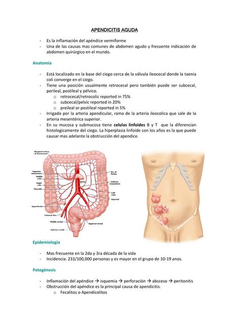 Apendicitis aguda