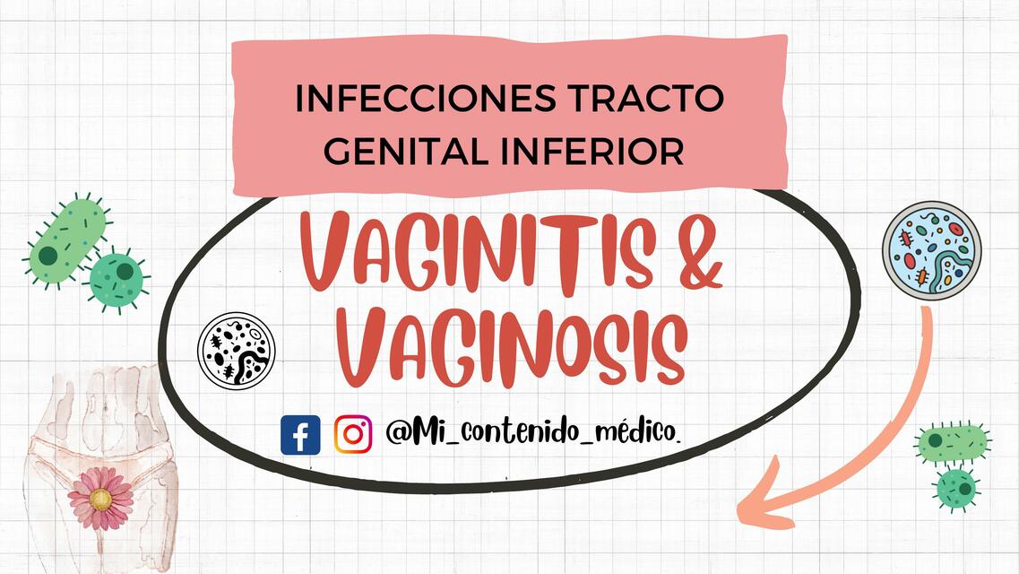 Vaginitis y vaginosis