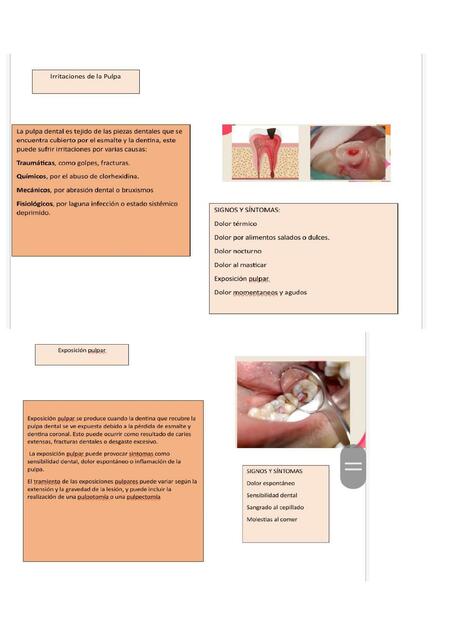 Irritaciones de la pulpa 