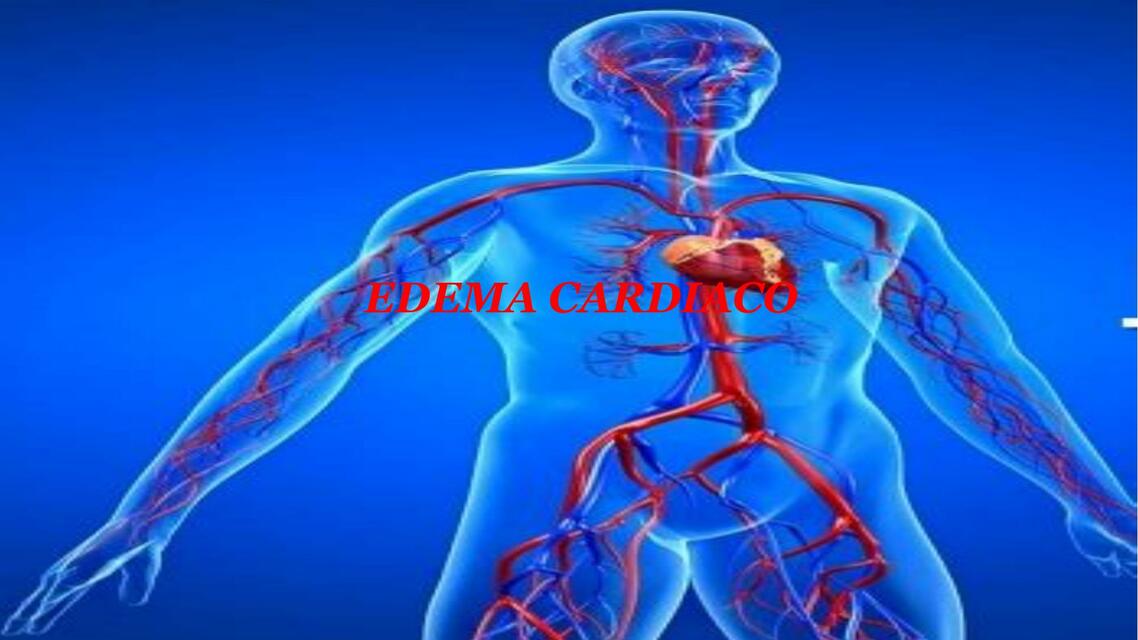 Edema cardiaco 