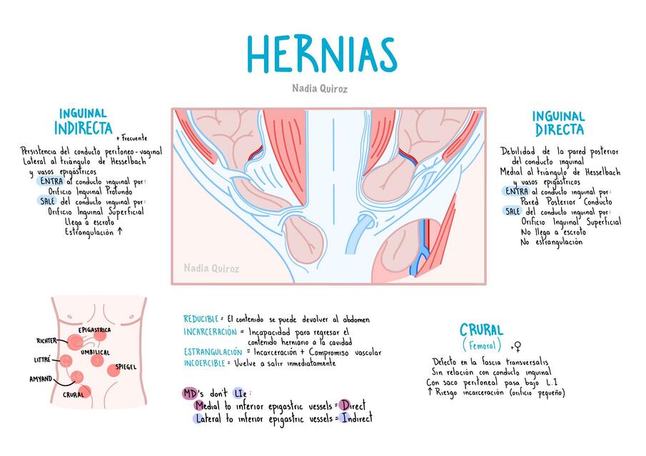 Hernias