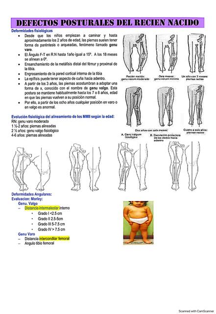 Defectos posturales del recién nacido 