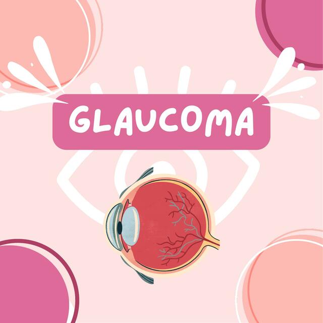 GLAUCOMA