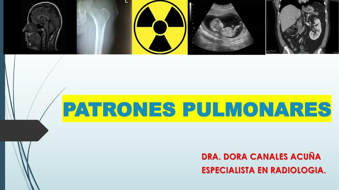 Patrones pulmonares 